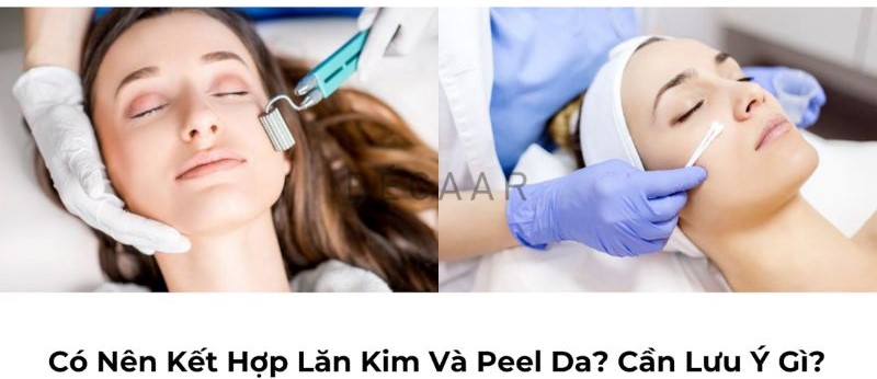 kết hợp lăn kim và peel da